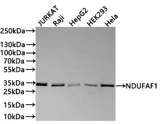 Western Blot
Positive WB detected in: Jurkat whole cell lysate(30µg) , Raji whole cell lysate(30µg) , HepG2 whole cell lysate(30µg) , HEK293 whole cell lysate(30µg) , Hela whole cell lysate(30µg) 
All lanes: NDUFAF1 antibody at 1:1000
Secondary
Goat polyclonal to rabbit IgG at 1/40000 dilution
Predicted band size: 38 kDa
Observed band size: 33 kDa
Exposure time：1min