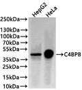 Western Blot
Positive WB detected in: HepG2 whole cell lysate(30µg) , HeLa whole cell lysate(30µg) 
All lanes: C4BPB antibody at 1:1000
Secondary
Goat polyclonal to rabbit IgG at 1/40000 dilution
Predicted band size: 28 kDa
Observed band size: 45 kDa
Exposure time：1min