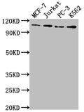 Western Blot
Positive WB detected in: MCF-7 whole cell lysate, Jurkat whole cell lysate, PC-3 whole cell lysate, K562 whole cell lysate
All lanes: KDM1A antibody at 1:2000
Secondary
Goat polyclonal to rabbit IgG at 1/50000 dilution
Predicted band size: 93, 96 kDa
Observed band size: 110 kDa