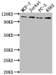 Western Blot
Positive WB detected in: MCF-7 whole cell lysate, Jurkat whole cell lysate, PC-3 whole cell lysate, K562 whole cell lysate
All lanes: KDM1A antibody at 1:2000
Secondary
Goat polyclonal to rabbit IgG at 1/50000 dilution
Predicted band size: 93, 96 kDa
Observed band size: 110 kDa