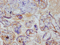 IHC image of CSB-RA222792A0HU diluted at 1:100 and staining in paraffin-embedded human placenta tissue performed on a Leica BondTM system. After dewaxing and hydration, antigen retrieval was mediated by high pressure in a citrate buffer (pH 6.0) . Section was blocked with 10% normal goat serum 30min at RT. Then primary antibody (1% BSA) was incubated at 4°C overnight. The primary is detected by a Goat anti-rabbit polymer IgG labeled by HRP and visualized using 0.05% DAB.