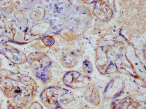 IHC image of CSB-RA222792A0HU diluted at 1:100 and staining in paraffin-embedded human placenta tissue performed on a Leica BondTM system. After dewaxing and hydration, antigen retrieval was mediated by high pressure in a citrate buffer (pH 6.0) . Section was blocked with 10% normal goat serum 30min at RT. Then primary antibody (1% BSA) was incubated at 4°C overnight. The primary is detected by a Goat anti-rabbit polymer IgG labeled by HRP and visualized using 0.05% DAB.