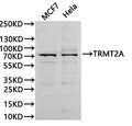 Western Blot, 
Positive WB detected in:MCF7 whole cell lysate(30µg), Hela whole cell lysate(30µg)
All lanes: TRMT2A antibody at 1:1000
Secondary
Goat polyclonal to rabbit IgG at 1/40000 dilution
Predicted band size: 69 kDa
Observed band size: 75 kDa
Exposure time：60s