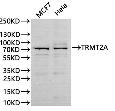 Western Blot, 
Positive WB detected in:MCF7 whole cell lysate(30µg), Hela whole cell lysate(30µg)
All lanes: TRMT2A antibody at 1:1000
Secondary
Goat polyclonal to rabbit IgG at 1/40000 dilution
Predicted band size: 69 kDa
Observed band size: 75 kDa
Exposure time：60s