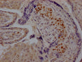 IHC image of CSB-RA224072A0HU diluted at 1:100 and staining in paraffin-embedded human placenta tissue performed on a Leica BondTM system. After dewaxing and hydration, antigen retrieval was mediated by high pressure in a citrate buffer (pH 6.0) . Section was blocked with 10% normal goat serum 30min at RT. Then primary antibody (1% BSA) was incubated at 4℃ overnight. The primary is detected by a Goat anti-rabbit IgG polymer labeled by HRP and visualized using 0.05% DAB.