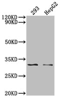 Western Blot
Positive WB detected in: 293 whole cell lysate, HepG2 whole cell lysate, 
All lanes: NDUFS3 antibody at 1:2000
Secondary
Goat polyclonal to rabbit IgG at 1/50000 dilution
Predicted band size: 31, 15 KDa
Observed band size: 31 kDa