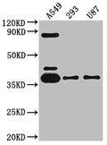 ADORA1 Antibody – Figure 1 of 2