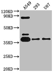 ADORA1 Antibody – Figure 1 of 2