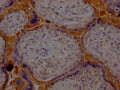 HP Antibody – Figure 1 of 2