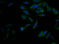 Immunofluorescence staining of Hela Cells with CSB-RA225569A0HU at 1:50, counter-stained with DAPI. The cells were fixed in 4% formaldehyde, permeated by 0.2% TritonX-100, and blocked in 10% normal Goat Serum. The cells were then incubated with the antibody overnight at 4℃. Nuclear DNA was labeled in blue with DAPI. The secondary antibody was FITC-conjugated AffiniPure Goat Anti-Rabbit IgG (H+L) .