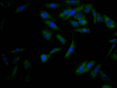 Immunofluorescence staining of Hela Cells with CSB-RA225569A0HU at 1:50, counter-stained with DAPI. The cells were fixed in 4% formaldehyde, permeated by 0.2% TritonX-100, and blocked in 10% normal Goat Serum. The cells were then incubated with the antibody overnight at 4℃. Nuclear DNA was labeled in blue with DAPI. The secondary antibody was FITC-conjugated AffiniPure Goat Anti-Rabbit IgG (H+L) .