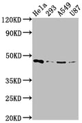 Western Blot
Positive WB detected in: Hela whole cell lysate, 293 whole cell lysate, A549 whole cell lysate, U87 whole cell lysate
All lanes: MAP2K1 antibody at 1:2000
Secondary
Goat polyclonal to rabbit IgG at 1/50000 dilution
Predicted band size: 44, 41 kDa
Observed band size: 44 kDa