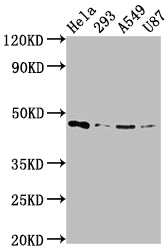 Western Blot
Positive WB detected in: Hela whole cell lysate, 293 whole cell lysate, A549 whole cell lysate, U87 whole cell lysate
All lanes: MAP2K1 antibody at 1:2000
Secondary
Goat polyclonal to rabbit IgG at 1/50000 dilution
Predicted band size: 44, 41 kDa
Observed band size: 44 kDa