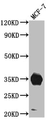 Western Blot
Positive WB detected in: MCF-7 whole cell lysate
All lanes: IGFBP2 antibody at 1:1000
Secondary
Goat polyclonal to rabbit IgG at 1/50000 dilution
Predicted band size: 35 kDa
Observed band size: 35 kDa