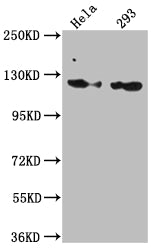 Western Blot
Positive WB detected in: Hela whole cell lysate, 293 whole cell lysate
All lanes: RNF20 antibody at 1:1000
Secondary
Goat polyclonal to rabbit IgG at 1/50000 dilution
Predicted band size: 114 kDa
Observed band size: 114 kDa