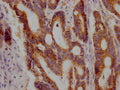 JAK1 Antibody – Figure 1 of 1