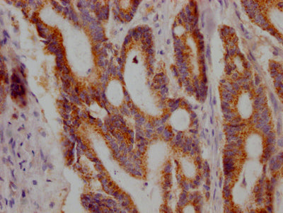 JAK1 Antibody – Figure 1 of 1