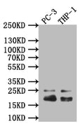 Western Blot
Positive WB detected in: THP-1 whole cell lysate
All lanes: Caveolin-1 antibody at 1:1000
Secondary
Goat polyclonal to rabbit IgG at 1/50000 dilution
Predicted band size: 20 kDa
Observed band size: 20 kDa
