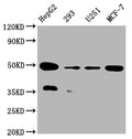 Western Blot
Positive WB detected in:HepG2 whole cell lysate, 293 whole cell lysate, U251 whole cell lysate, MCF-7 whole cell lysate
All lanes: UQCRC2 antibody at 1:2000
Secondary
Goat polyclonal to rabbit IgG at 1/50000 dilution
Predicted band size: 49 kDa
Observed band size: 49 kDa