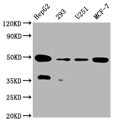 Western Blot
Positive WB detected in:HepG2 whole cell lysate, 293 whole cell lysate, U251 whole cell lysate, MCF-7 whole cell lysate
All lanes: UQCRC2 antibody at 1:2000
Secondary
Goat polyclonal to rabbit IgG at 1/50000 dilution
Predicted band size: 49 kDa
Observed band size: 49 kDa
