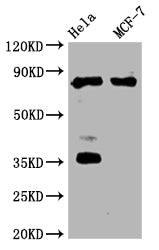 Western Blot
Positive WB detected in:Hela whole cell lysate, MCF-7 whole cell lysate
All lanes: STAT3 antibody at 1:2000
Secondary
Goat polyclonal to rabbit IgG at 1/50000 dilution
Predicted band size: 89, 88, 84 kDa
Observed band size: 89 kDa