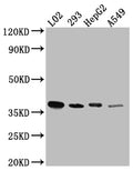Western Blot
Positive WB detected in: L02 whole cell lysate, HEK293 whole cell lysate, HepG2 whole cell lysate, A549 whole cell lysate
All lanes: LRG1 antibody at 1:1000
Secondary
Goat polyclonal to rabbit IgG at 1/50000 dilution
Predicted band size: 39 kDa
Observed band size: 39 kDa