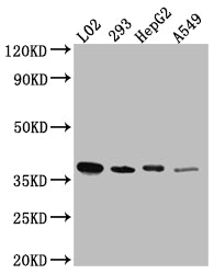 Western Blot
Positive WB detected in: L02 whole cell lysate, HEK293 whole cell lysate, HepG2 whole cell lysate, A549 whole cell lysate
All lanes: LRG1 antibody at 1:1000
Secondary
Goat polyclonal to rabbit IgG at 1/50000 dilution
Predicted band size: 39 kDa
Observed band size: 39 kDa