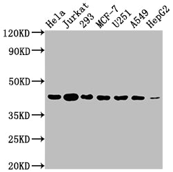Western Blot
Positive WB detected in: Hela whole cell lysate, Jurkat whole cell lysate, 293 whole cell lysate, MCF-7 whole cell lysate, U251 whole cell lysate, A549 whole cell lysate, HepG2 whole cell lysate
All lanes: AURKB antibody at 1:2000
Secondary
Goat polyclonal to rabbit IgG at 1/50000 dilution
Predicted band size: 40, 36, 17, 35 kDa
Observed band size: 40 kDa