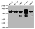 DDX5 Antibody – Figure 1 of 4