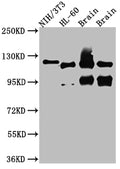 Western Blot
Positive WB detected in: NIH/3T3 whole cell lysate, HL-60 whole cell lysate, Rat Brain whole cell lysate, Mouse Brain whole cell lysate
All lanes: OGT antibody at 1:1000
Secondary
Goat polyclonal to rabbit IgG at 1/50000 dilution
Predicted band size: 117, 104, 116, 75 kDa
Observed band size: 117 kDa