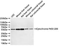 Western Blot
Positive WB detected in: LO2 whole cell lysate(30µg) , Mouse liver tissue lysate(30µg) ) , Rat liver tissue lysate(30µg) ) , Mouse colorectal tissue lysate(30µg) ) , Rat colorectal tissue lysate(30µg) 
All lanes: Cytochrome P450 2D6 antibody at 1:1000
Secondary
Goat polyclonal to rabbit IgG at 1/40000 dilution
Predicted band size: 56 kDa
Observed band size: 56 kDa
Exposure time：20s