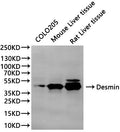 Western Blot, 
Positive WB detected in:COLO205 whole cell lysate(30µg), Mouse liver tissue lysate(30µg), Rat liver lysate(30µg)
All lanes: ADH1A antibody at 1:1000
Secondary
Goat polyclonal to rabbit IgG at 1/40000 dilution
Predicted band size: 40 kDa
Observed band size: 40 kDa
Exposure time：120s
