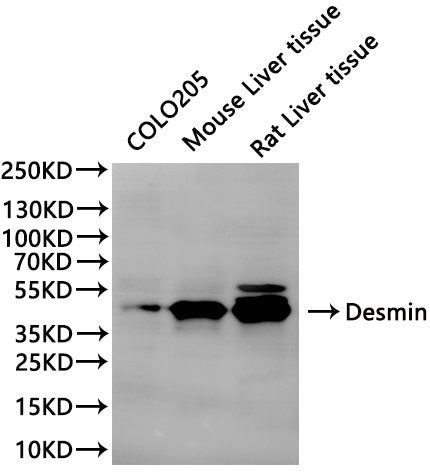 Western Blot, 
Positive WB detected in:COLO205 whole cell lysate(30µg), Mouse liver tissue lysate(30µg), Rat liver lysate(30µg)
All lanes: ADH1A antibody at 1:1000
Secondary
Goat polyclonal to rabbit IgG at 1/40000 dilution
Predicted band size: 40 kDa
Observed band size: 40 kDa
Exposure time：120s