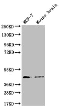 Western Blot
Positive WB detected in: MCF-7 whole cell lysate, Mouse brain tissue
All lanes: SLC27A4 antibody at 1:1000
Secondary
Goat polyclonal to rabbit IgG at 1/50000 dilution
Predicted band size: 73, 27 kDa
Observed band size: 42 kDa