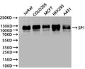 Western Blot
Positive WB detected in: Jurkat whole cell lysate(30µg), COLO205 whole cell lysate(30µg), MCF7 whole cell lysate(30µg), HEK293 whole cell lysate(30µg), A431 whole cell lysate(30µg)
All lanes: SP1 antibody at 1:1000
Secondary
Goat polyclonal to rabbit IgG at 1/40000 dilution
Predicted band size: 81 kDa
Observed band size: 110 kDa
Exposure time：2min