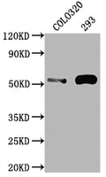 Western Blot
Positive WB detected in: COLO320 whole cell lysate, 293 whole cell lysate
All lanes: TP53 antibody at 1:2000
Secondary
Goat polyclonal to rabbit IgG at 1/50000 dilution
Predicted band size: 44, 38, 39, 40, 34, 35, 30, 24, 25 kDa
Observed band size: 53 kDa