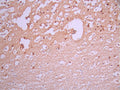 IHC image of CSB-RA236968A0HU diluted at 1:100 and staining in paraffin-embedded human brain tissue performed on a Leica BondTM system. After dewaxing and hydration, antigen retrieval was mediated by high pressure in a citrate buffer (pH 6.0). Section was blocked with 10% normal goat serum 30min at RT. Then primary antibody (1% BSA) was incubated at 4°C overnight. The primary is detected by a Goat anti-rabbit polymer IgG labeled by HRP and visualized using 0.05% DAB.