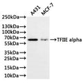 Western Blot
Positive WB detected in: A431 whole cell lysate(30µg), MCF-7 whole cell lysate(30µg)
All lanes: TFIIE alpha antibody at 1:1000
Secondary
Goat polyclonal to rabbit IgG at 1/40000 dilution
Predicted band size: 49 kDa
Observed band size: 60 kDa
Exposure time：3min