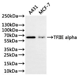 Western Blot
Positive WB detected in: A431 whole cell lysate(30µg), MCF-7 whole cell lysate(30µg)
All lanes: TFIIE alpha antibody at 1:1000
Secondary
Goat polyclonal to rabbit IgG at 1/40000 dilution
Predicted band size: 49 kDa
Observed band size: 60 kDa
Exposure time：3min