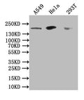 DOT1L Antibody – Figure 1 of 2