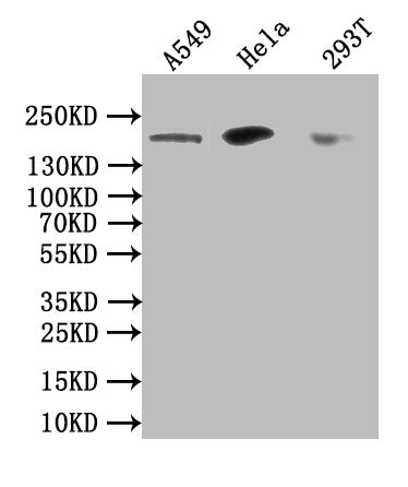 DOT1L Antibody – Figure 1 of 2