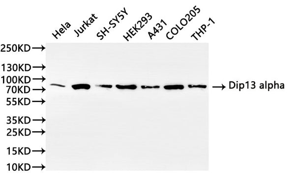 Western Blot, 
Positive WB detected in: Hela whole cell lysate(30µg), Jurkat whole cell lysate(30µg), SH-SY5Y whole cell lysate(30µg), colo205 whole cell lysate(30µg), A431 whole cell lysate(30µg), THP-1 whole cell lysate(30µg)
All lanes: Dip13 alpha antibody at 1:1000
Secondary
Goat polyclonal to rabbit IgG at 1/40000 dilution
Predicted band size: 80 kDa
Observed band size: 85 kDa
Exposure time：10s