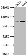 Western Blot
Positive WB detected in: Hela whole cell lysate, K562 whole cell lysate
All lanes: PIK3CB antibody at 1:1500
Secondary
Goat polyclonal to rabbit IgG at 1/50000 dilution
Predicted band size: 123 kDa
Observed band size: 110 kDa