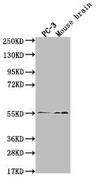 Western Blot
Positive WB detected in: PC-3 whole cell lysate, Mouse brain tissue
All lanes: MAPK10 antibody at 1:2000
Secondary
Goat polyclonal to rabbit IgG at 1/50000 dilution
Predicted band size: 53, 49, 32kDa
Observed band size: 55 kDa