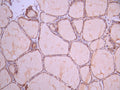 IHC image of CSB-RA240498A0HU diluted at 1:100 and staining in paraffin-embedded human thyroid tissue performed on a Leica BondTM system. After dewaxing and hydration, antigen retrieval was mediated by high pressure in a citrate buffer (pH 6.0). Section was blocked with 10% normal goat serum 30min at RT. Then primary antibody (1% BSA) was incubated at 4°C overnight. The primary is detected by a Goat anti-rabbit polymer IgG labeled by HRP and visualized using 0.05% DAB.