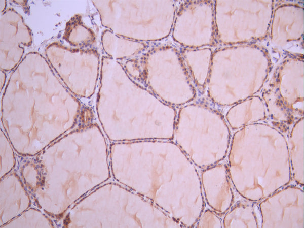 IHC image of CSB-RA240498A0HU diluted at 1:100 and staining in paraffin-embedded human thyroid tissue performed on a Leica BondTM system. After dewaxing and hydration, antigen retrieval was mediated by high pressure in a citrate buffer (pH 6.0). Section was blocked with 10% normal goat serum 30min at RT. Then primary antibody (1% BSA) was incubated at 4°C overnight. The primary is detected by a Goat anti-rabbit polymer IgG labeled by HRP and visualized using 0.05% DAB.