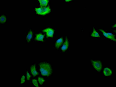 FASN Antibody – Figure 1 of 2