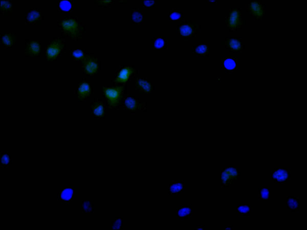 Immunofluorescence staining of Hela cell with CSB-RA240912A0HU at 1:50, counter-stained with DAPI. The cells were fixed in 4% formaldehyde, permeabilized using 0.2% Triton X-100 and blocked in 10% normal Goat Serum. The cells were then incubated with the antibody overnight at 4°C. The secondary antibody was Alexa Fluor 488-congugated AffiniPure Goat Anti-Rabbit IgG(H+L) .