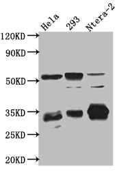 Western Blot
Positive WB detected in: Hela whole cell lysate, HEK293 whole cell lysate, Ntera-2 cell lysate
All lanes: CASP3 antibody at 1:1000
Secondary
Goat polyclonal to rabbit IgG at 1/50000 dilution
Predicted band size: 32 kDa
Observed band size: 32, 55, 130 kDa