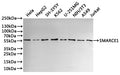 Western Blot
Positive WB detected in: Hela whole cell lysate(30µg), HepG2 whole cell lysate(30µg), SH-SY5Y whole cell lysate(30µg), K562 whole cell lysate(30µg), whole cell lysate(30µg), U-251MG whole cell lysate(30µg), NIH/3T3 whole cell lysate(30µg), A549 whole cell lysate(30µg), Jurkat whole cell lysate(30µg)
All lanes: SMARCE1 antibody at 1:1000
Secondary
Goat polyclonal to rabbit IgG at 1/40000 dilution
Predicted band size: 47 kDa
Observed band size: 57 kDa
Exposure time：3min